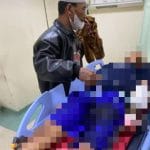 Pemuda di Pati Dianiaya Brutal, Dua Jari Putus